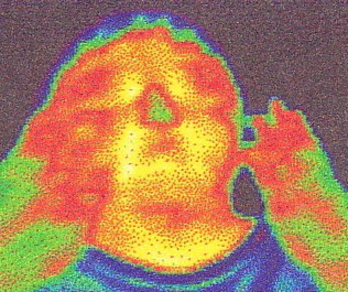 microcirculatie_2_2.jpg