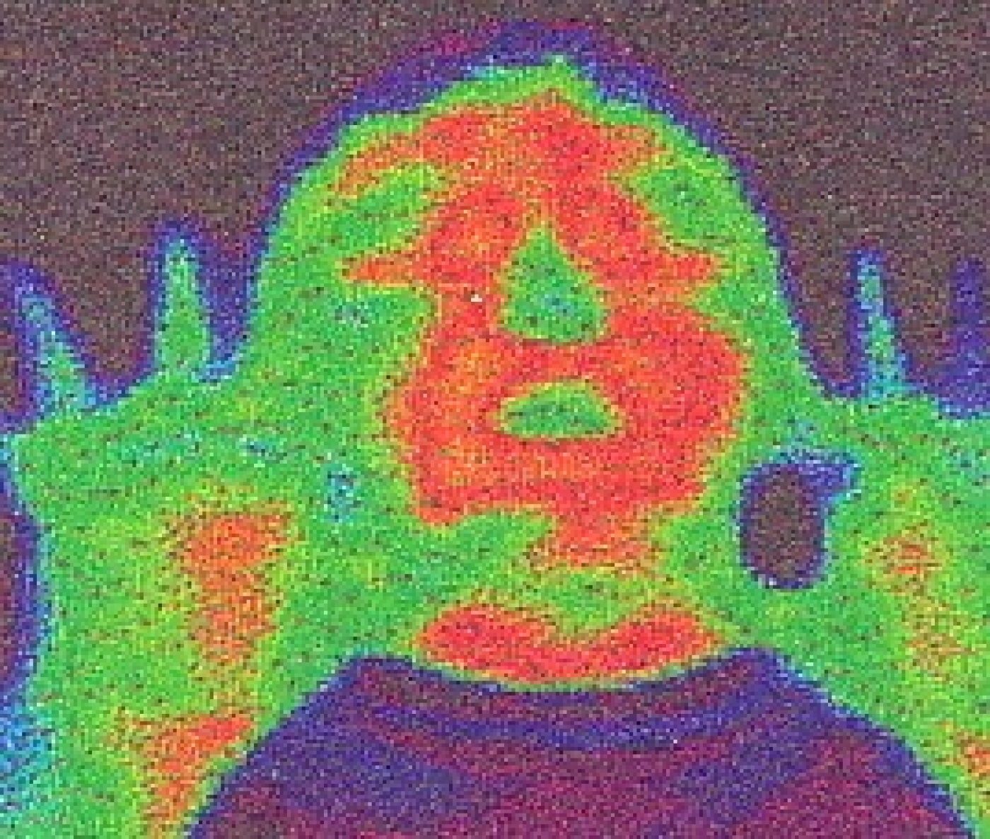 microcirculatie_2.jpg